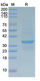 Recombinant HCMV/HHV5 gH/UL75 Protein, N-His