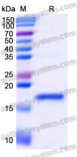 Recombinant Hepatitis B virus/HBV X/HBx Protein, N-His