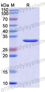 Recombinant TVBMV Polyprotein Protein, N-His