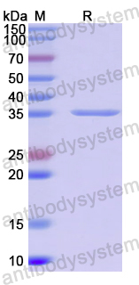 Recombinant PeVYV Putative P3 protein, N-His-SUMO