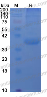 Recombinant CHIKV Spike glycoprotein E2 Protein, N-His