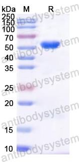 Recombinant HPV18 L1/Major capsid protein L1 Protein, C-His