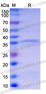 Recombinant Monkeypox virus/MPXV B5R Protein, N-His