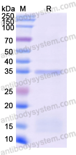 Recombinant Monkeypox virus/MPXV D13L Protein, N-His