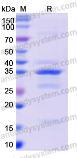 Recombinant Monkeypox virus/MPXV A26L Protein, N-GST & C-His