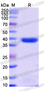 Recombinant Monkeypox virus/MPXV A35R Protein, N-GST & C-His