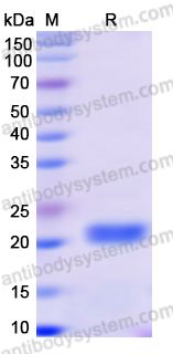 Recombinant Monkeypox virus/MPXV M1R Protein, N-His