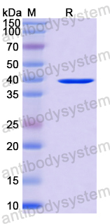 Recombinant Langya virus/LayV M/Matrix Protein, N-His