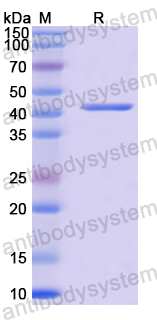 Recombinant Langya virus/LayV F/Fusion Protein, N-His