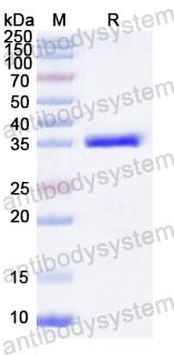 Recombinant CVA6 VP4/Capsid protein VP4 Protein, N-GST & C-His