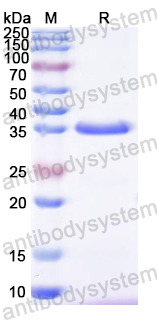 Recombinant CA16 VP4/P1A Protein, N-GST & C-His