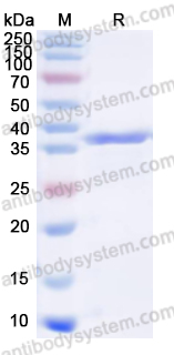 Recombinant EV71 VP1/Capsid protein VP1 Protein, N-His