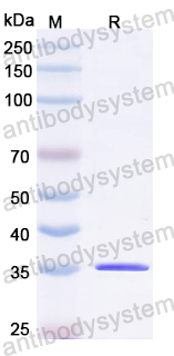 Recombinant EV71 VP4/P1A Protein, N-GST & C-His
