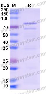 Recombinant Bacteriophage T4 DNA ligase/30 Protein, N-His-SUMO & C-Strep