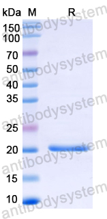 Recombinant Rubella virus/RUBV Polyprotein Protein, N-His