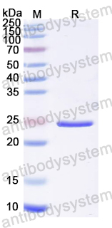 Recombinant Influenza A virus (H7N9) NF (CsgA)-3M2e Protein, N-His