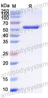 Recombinant Influenza A virus (H1N1) NR (N)-3M2e Protein, N-His