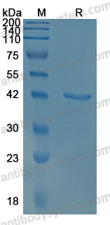 Recombinant Influenza A virus (H3N2) NA/Neuraminidase Protein, N-His