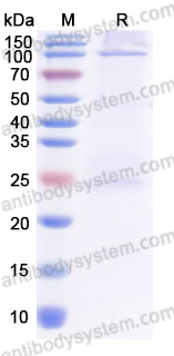 Recombinant MARV NP/Nucleoprotein Protein, N-His
