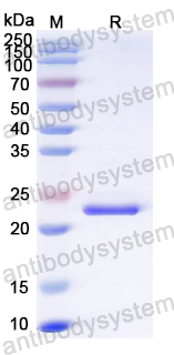 Recombinant JUNV GP2 Protein, N-His