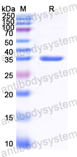 Recombinant CDV Phosphoprotein/P Protein, N-GST & C-His