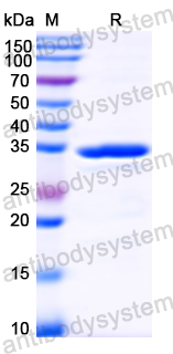 Recombinant HMPV Phosphoprotein/P Protein, N-His