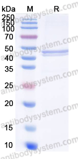 Recombinant HMPV N/Nucleoprotein Protein, N-His