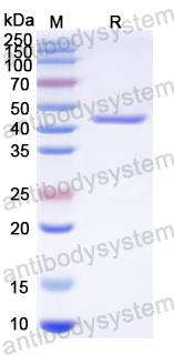 Recombinant HMPV N/Nucleoprotein Protein, N-His