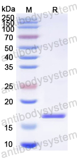 Recombinant PRRSV Nucleoprotein Protein, N-His