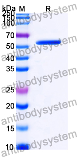 Recombinant PEDV S1/Spike glycoprotein 1 Protein, N-His & C-His