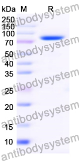 Recombinant PEDV S1/Spike glycoprotein 1 Protein, N-His
