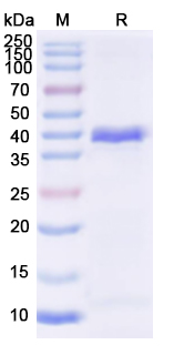 Recombinant EEEV Spike glycoprotein E2 Protein, N-His