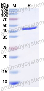 Recombinant WEEV Spike glycoprotein E2 Protein, N-His