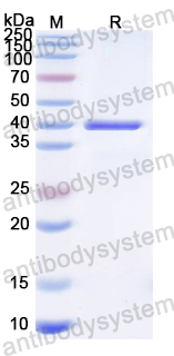Recombinant MeV M/Matrix protein Protein, N-His