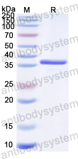 Recombinant RUBV Spike glycoprotein E1 Protein, N-His