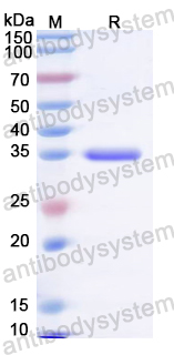 Recombinant RHDV VP60/Capsid protein VP60 Protein, C-His
