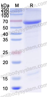 Recombinant FCV Capsid protein VP1 Protein, N-His