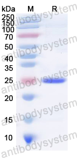 Recombinant MuV HN/Hemagglutinin-neuraminidase Protein, N-His