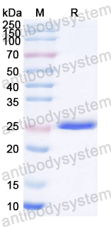 Recombinant ASFV UBC/pI215L Protein, N-His