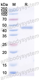 Recombinant ASFV CP2475L (p37) Protein, N-His