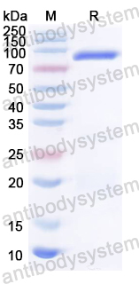 Recombinant HSV-1/HHV-1 UL21 Protein, N-GST & C-His