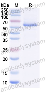 Recombinant IBV S1/Spike glycoprotein 1 Protein, C-His