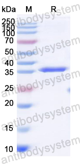 Recombinant EV68 VP1/P1D Protein, N-His
