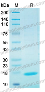Recombinant PDCoV M/Membrane protein Protein, N-His