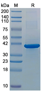 Recombinant CHIKV NSP1 Protein, N-His