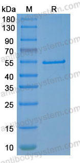 Recombinant SEOV N/Nucleoprotein Protein, N-His