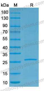 Recombinant VSIV M/Matrix protein Protein, N-His