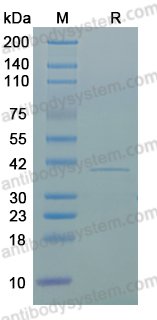Recombinant HeV M/Matrix protein Protein, N-His