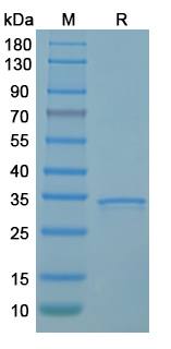 SDS-PAGE for Recombinant MPXV/MPOX A17L Protein, C-His ?>