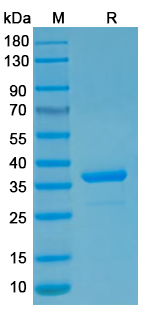 Recombinant MPXV/MPOX A16L Protein, N-GST & C-His